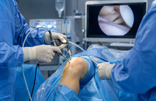 Knee Replacement 1 Knee Replacement Surgery In UAE