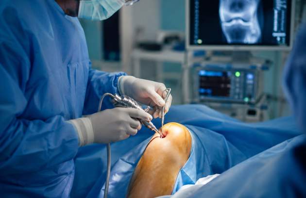 Knee 3 Knee Surgery In Abu Dhabi