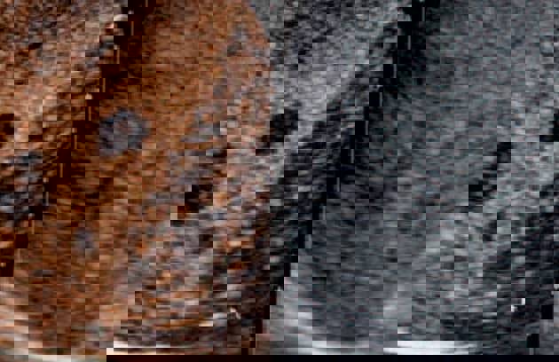Contrast Enhanced Ultrasound (2) Min