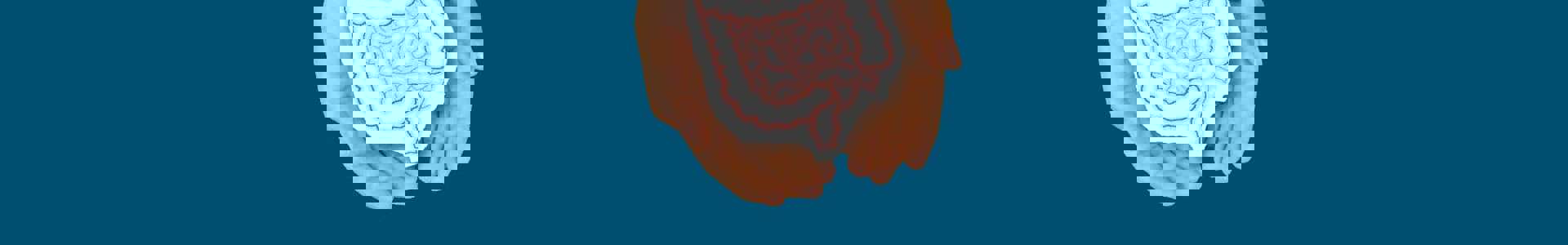 Web Banner Colon Cancer Mr New Min