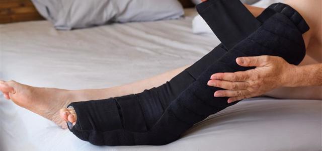Lymphedema